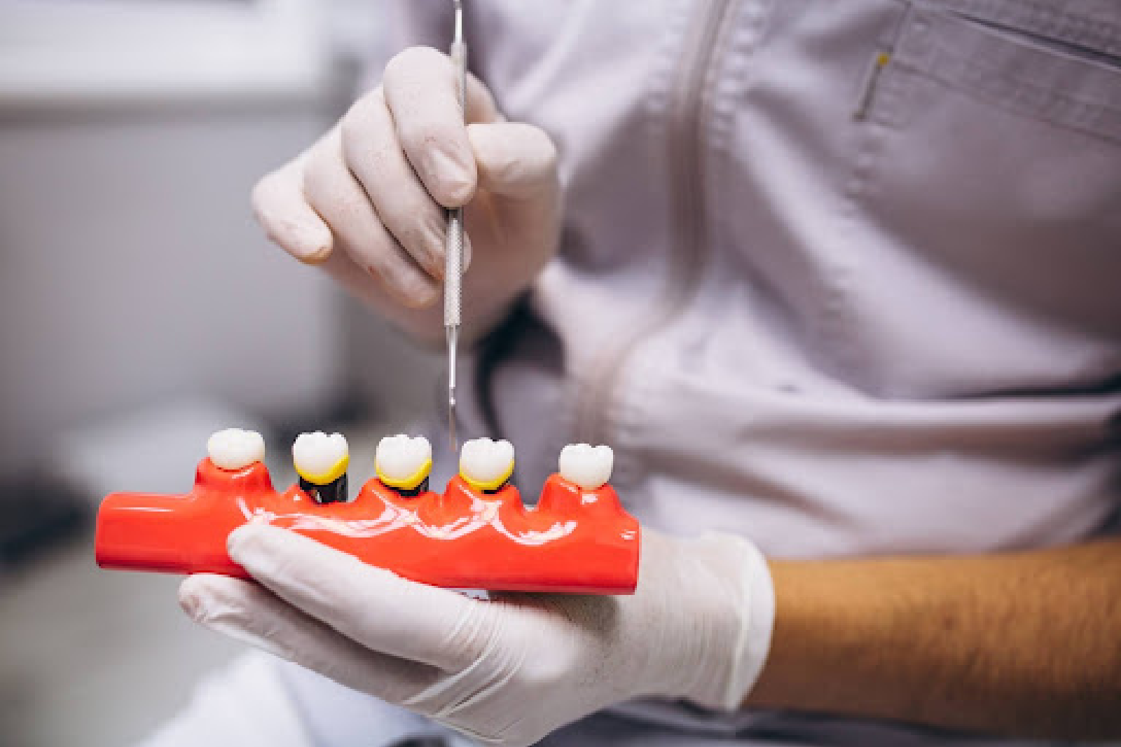Dental Crown and Bridge in Brookefield, Bangalore