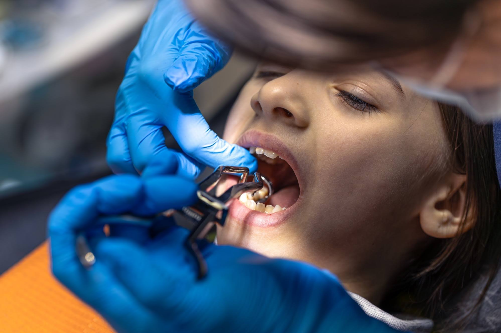 Pediatric Dentist in Brookefield, Bangalore